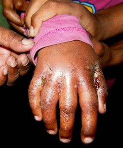 0-hand-flat_6923-wW